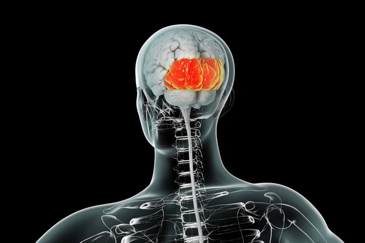 Dr. Sérgio Adrian Fernandes Dantas - Neurocirurgia - Desvendando Esclerose Múltipla: A Relação Entre Lesões Cerebrais E Gravidade Da Doença