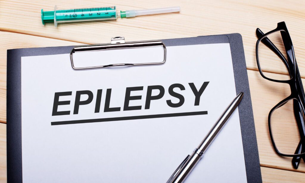 Fatos Sobre A Epilepsia