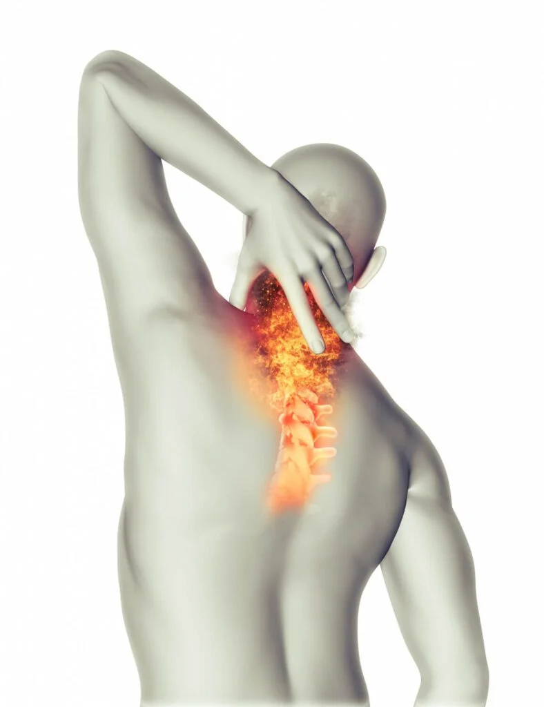 Dr. Sérgio Adrian Fernandes Dantas - Neurocirurgia - Entendendo A Hérnia De Disco: Causas, Sintomas E Tratamentos Entendendo A Hérnia De Disco: Causas, Sintomas E Tratamentos