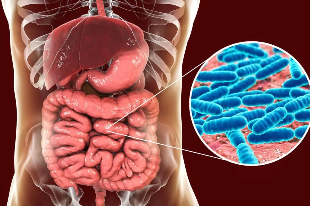 Dr. Sérgio Adrian Fernandes Dantas - Neurocirurgia - Bactéria Intestinal Pode Agravar A Doença De Parkinson, Conclui Estudo Bactéria