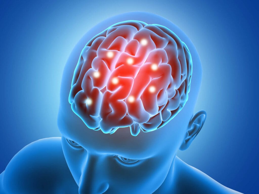 Dr. Sérgio Adrian Fernandes Dantas - Neurocirurgia - Sedentarismo E Dores Neurológicas: Entenda A Relação E Saiba Como Prevenir Desconfortos Sedentarismo E Dores Neurológicas